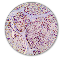 TRPS1 (EP392), RMab - Rabbit Monoclonal